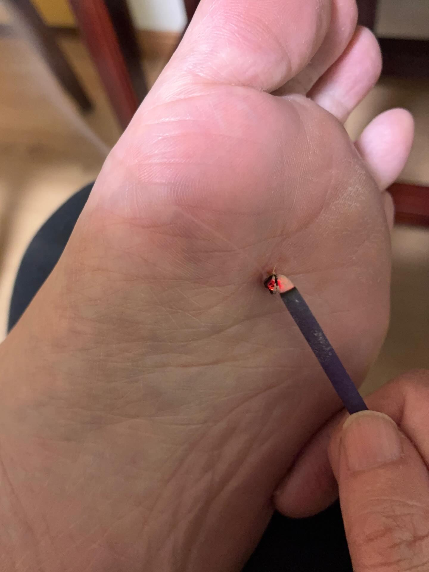 【2025年最後のお灸交流会】